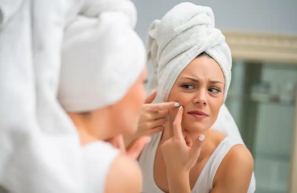 บีบสิวดีไหม