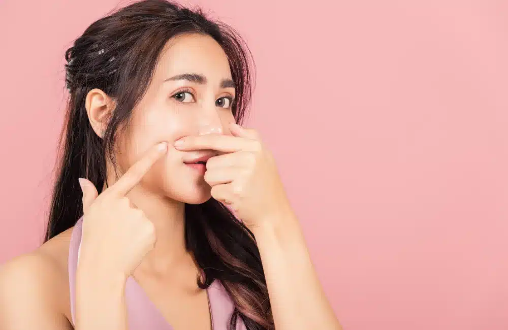 บีบสิวดีไหม