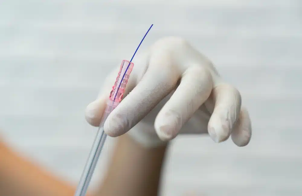 ร้อยไหม คือ