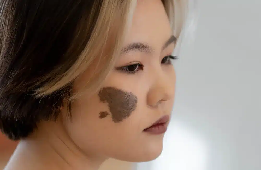 ปานโอตะ คืออะไร