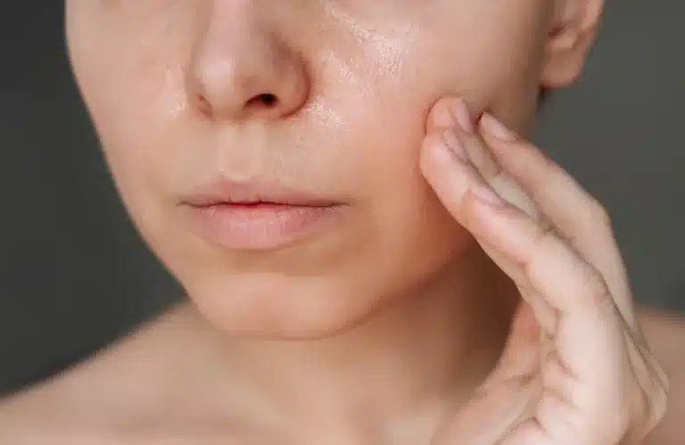 วิธีแก้หน้ามัน รูขุมขนกว้าง