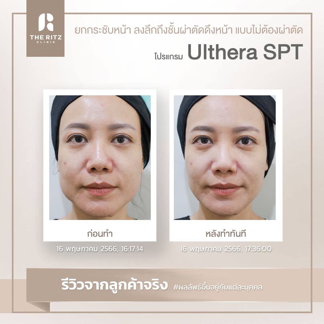 SPT08