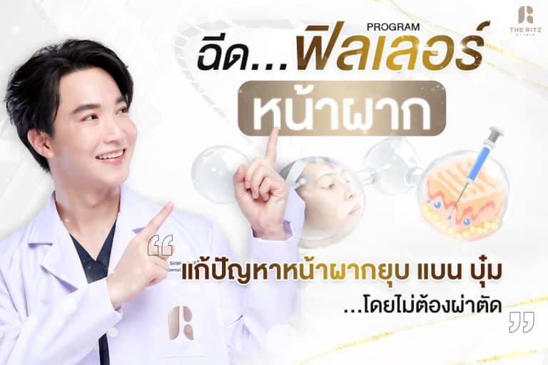 ฉีดฟิลเลอร์หน้าผาก แก้ปัญหาหน้าผากยุบ แบน บุ๋ม โดยไม่ต้องผ่าตัด