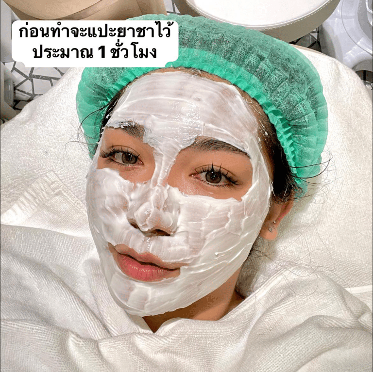 รีวิว Pico Laser รักษาหลุมสิว รอยดำ รอยสิว โดยคุณออย