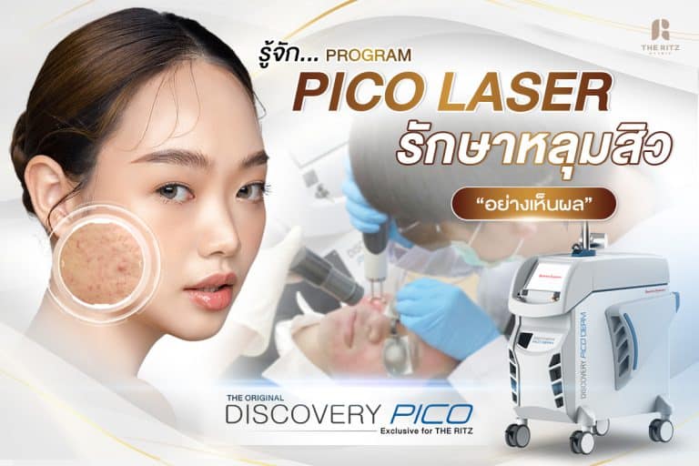 รู้จัก Pico Laser เลเซอร์รักษาหลุมสิว หน้าเป็นหลุม อย่างเห็นผล