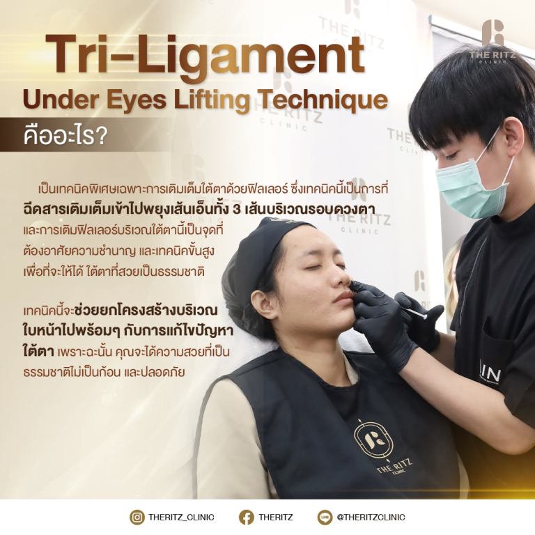 Tri-Ligament Under Eyes Lifting Technique คืออะไร