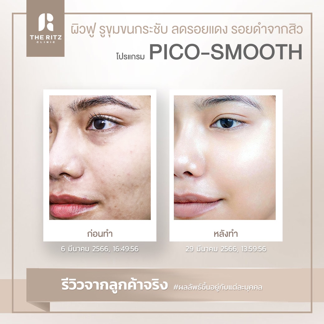smooth08
