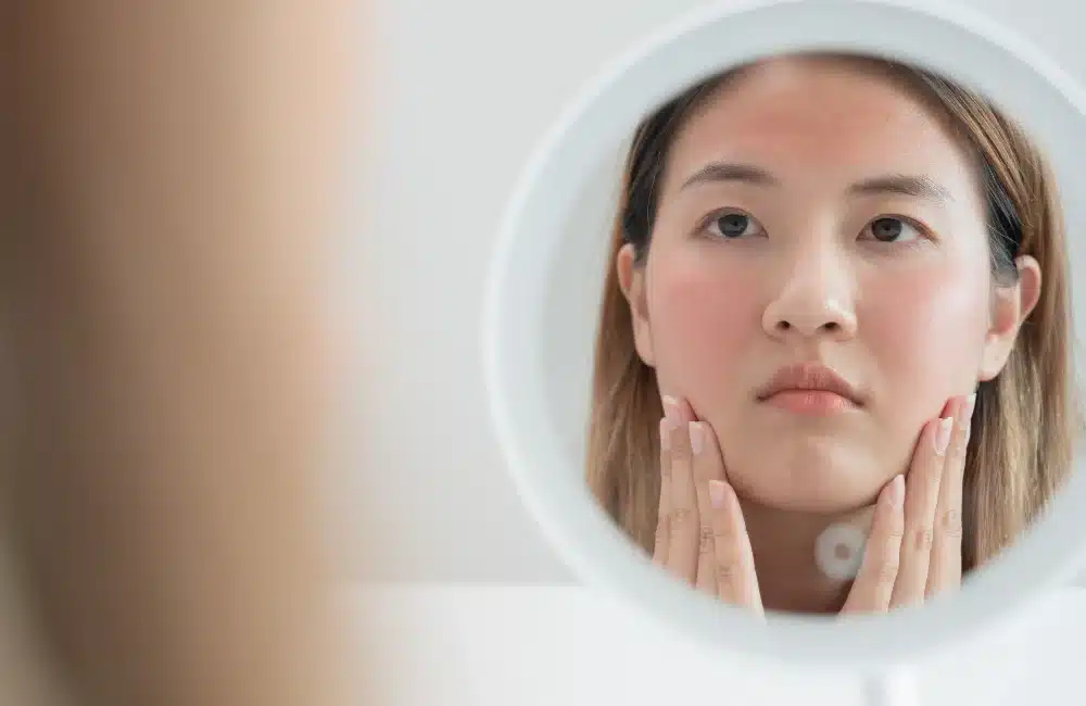 ปรับผิวคล้ำเสียจากแดดให้กระจ่างใสได้ด้วย Rejuran