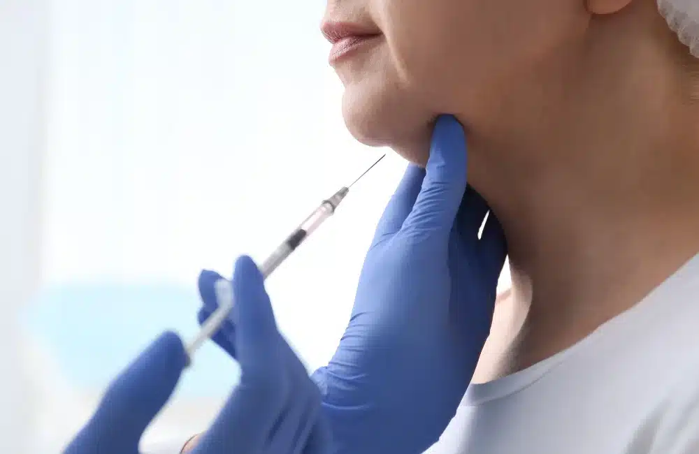 Profhilo คืออะไร