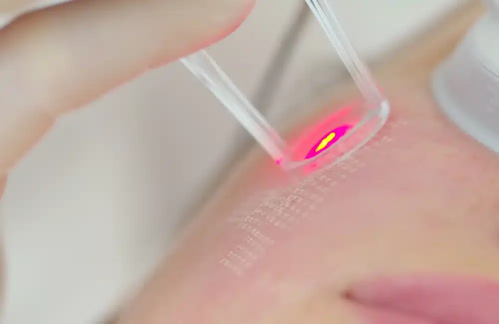 ไขข้อสงสัย Pico อันตรายไหม มีข้อดี-ข้อเสียอะไรบ้างที่ควรรู้