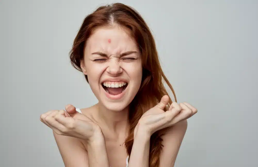 บีบสิวดีไหม