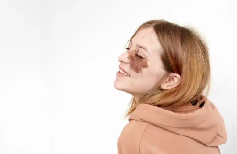 ปานโอตะ คืออะไร